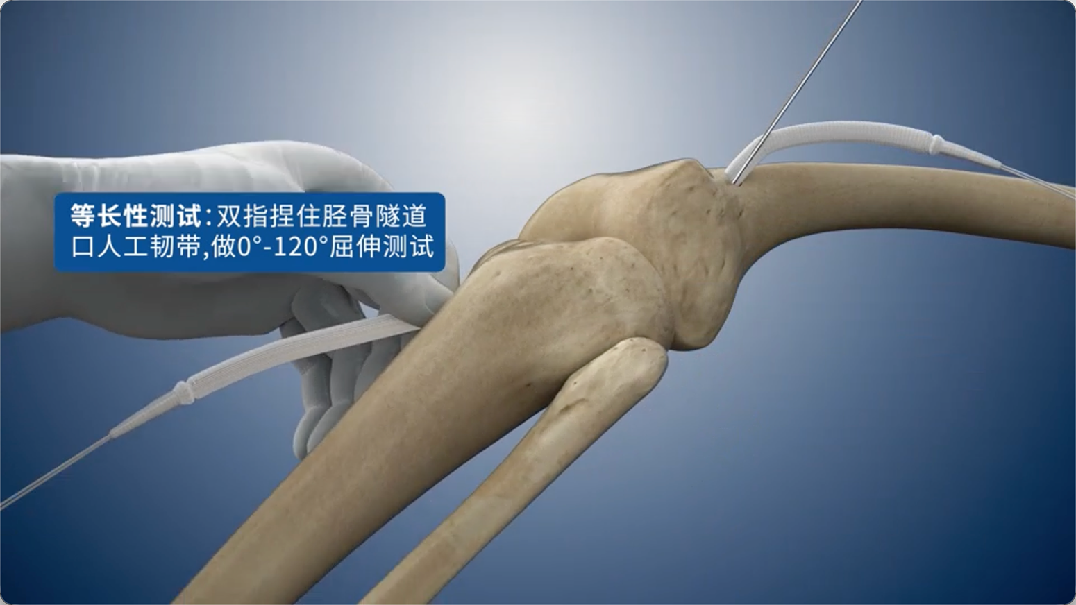 等长性测试：双指捏住胫骨隧道口人工韧带，做0°-120°屈伸测试
