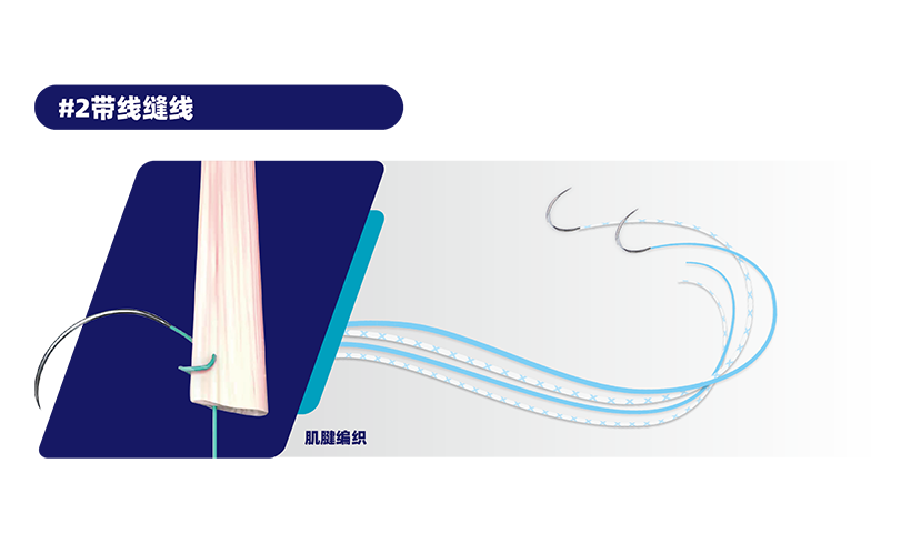 缝线