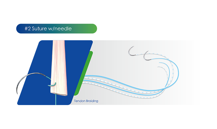 Suture