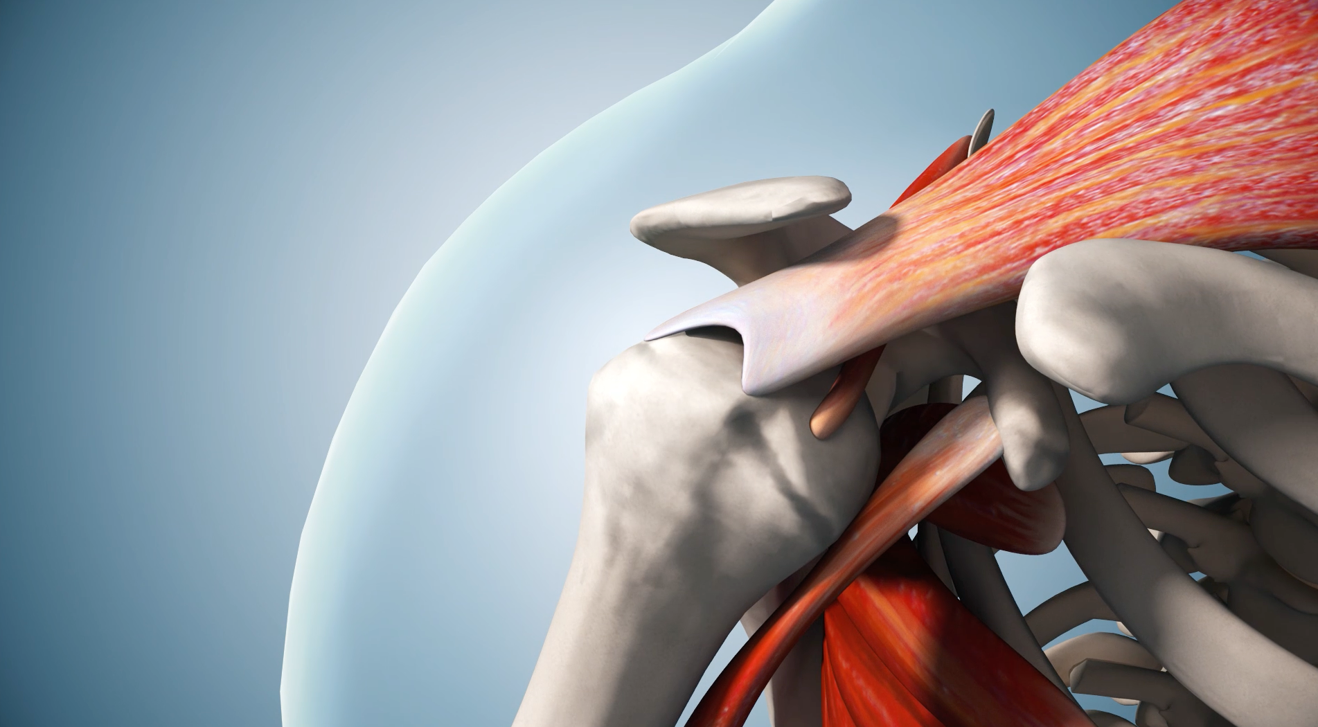 Ligatech Rotator cuff repair animation