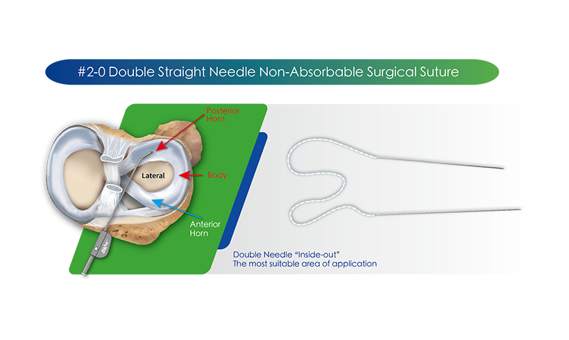 Suture