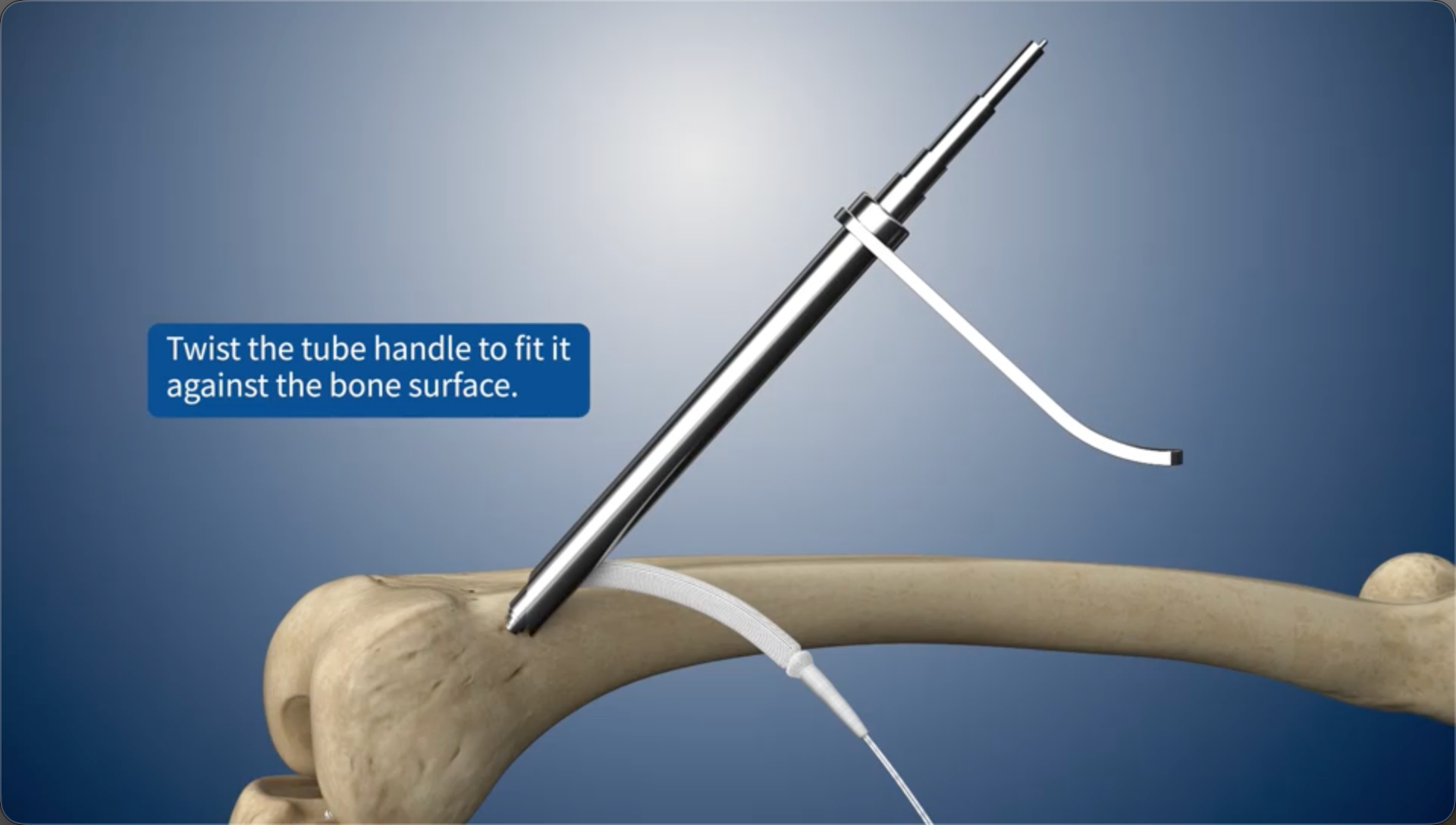 Twist the tube handle to fit it against the bone surface.
